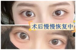 -素美医疗美容·西南眼鼻整形·修复基地