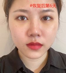 -广州健丽·去眼袋医疗美容机构