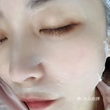 （能把一脸爆痘去的那么自然美 爱啦 爱啦）