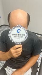 -唐风采假发补发定制