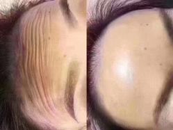 -香薇妮丝·定制减肥·身材管理