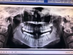 -泰康拜博口腔医院(江北总院)