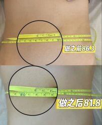 -Fundi张玉珊修身堂·indiba·BTL科技瘦身