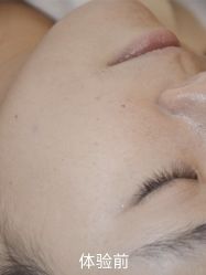 -清疣美疣·痣·斑净肤中心