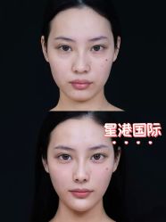 点击看大图 -星港国际·Skin皮肤专研·皮肤管理