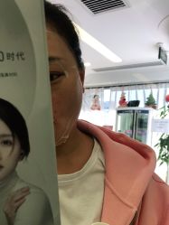 体验前-联合丽格·张菡丽格医疗美容