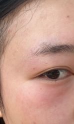 -素美医疗美容·西南眼鼻整形·修复基地