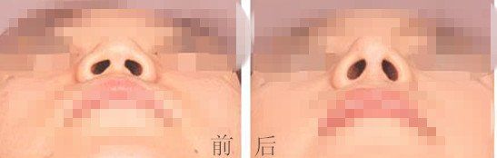 -CMS西美斯·美式医疗美容