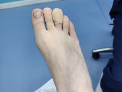 -Andrew指甲专科灰指甲·甲沟炎矫正·3D步态矫形鞋垫定制(浦三路店)