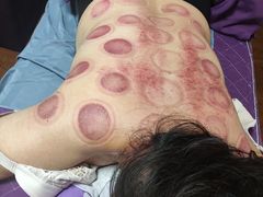 -沈师傅盲人按摩工作室(密三小区店)