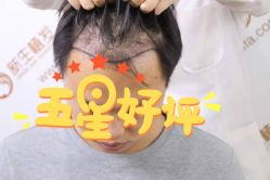 -新生植发·植养护一体