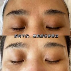 -美肤盾祛痘·问题肌头疗管理中心