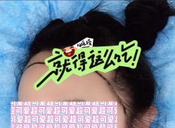 -大麦微针植发全国连锁