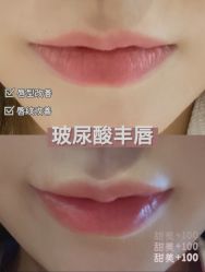 -上海漾颜医疗美容