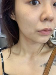 -小忠丽格医美