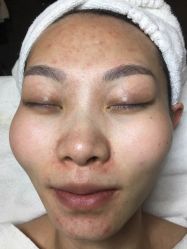 -皇族养心堂·净痘·修敏·御颜