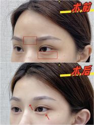 -深圳艺星医疗美容医院
