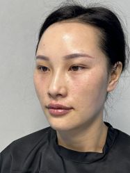 体验后-贵阳美莱医疗美容整形医院