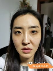 -小忠丽格医美