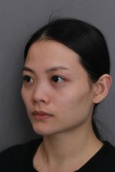 -北京米扬丽格医疗美容·联合丽格鼻整形中心