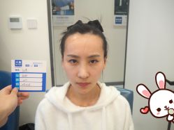 -大麦微针植发丨全国连锁