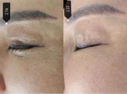 -厦门美莱整形美容医院