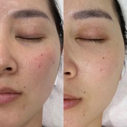 -尊尚柏丽美容SPA