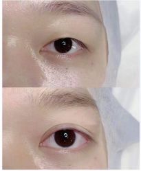 -上海漾颜医疗美容