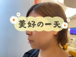 体验前-天津伊美尔医疗整形美容专科医院