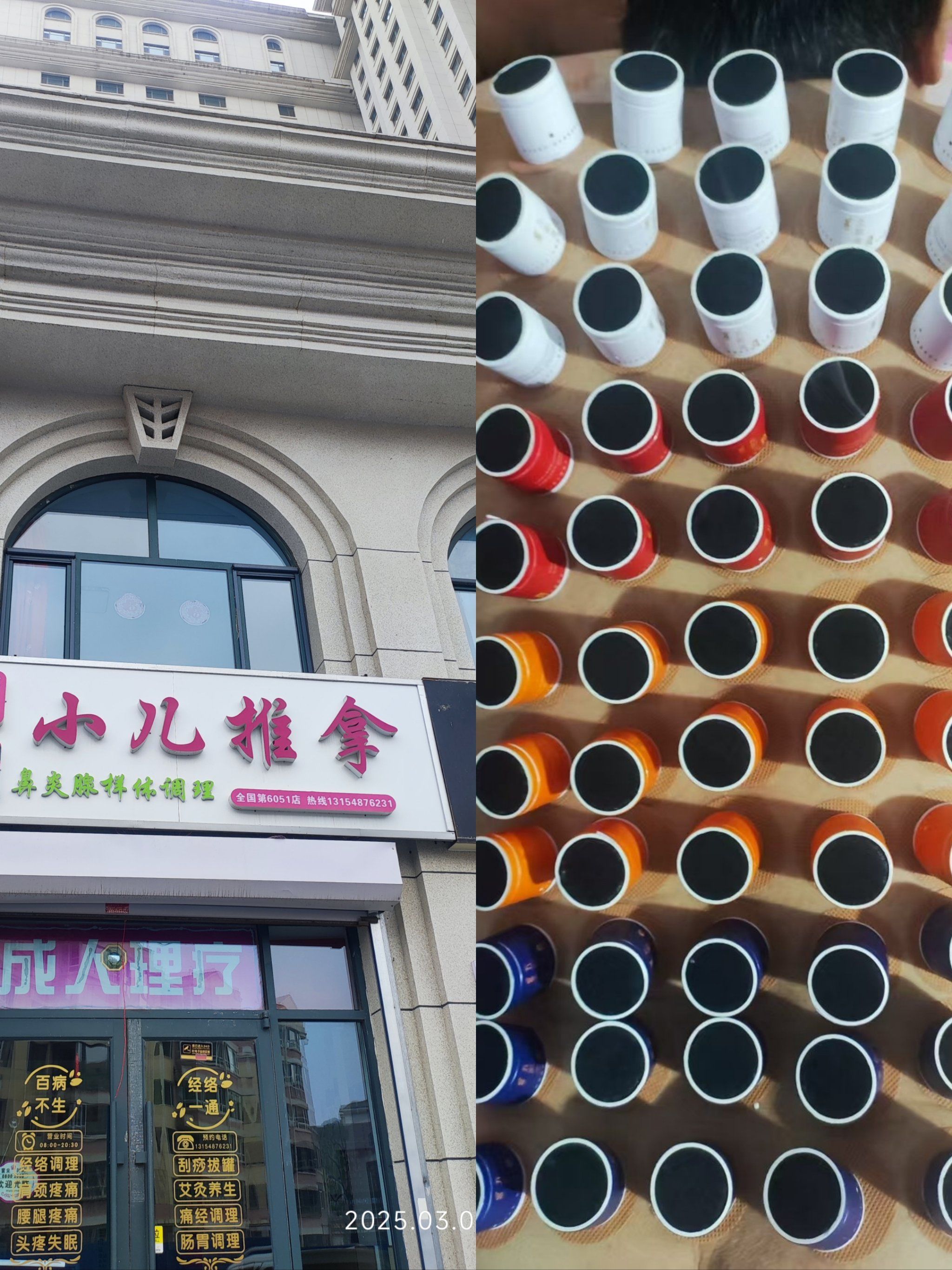 小美医生小儿推拿