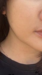 -广州美莱医疗美容医院