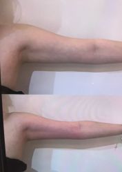 点击看大图 -栖SPA·ONDA ·美肤炫·海菲秀科技美肤中心