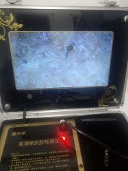 -蕾特恩专业祛痘国际连锁