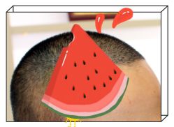 -大麦微针植发全国连锁