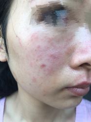 -北京米扬丽格医疗美容·联合丽格鼻整形中心