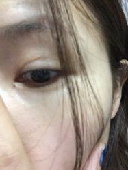 -叶美人医疗美容