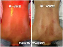 -丽减美瘦吧·减肥瘦身