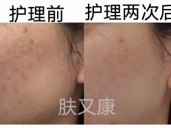 -天其美科学美肤·生发健康管理