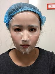 体验后-南京康美美容医院·旗舰店