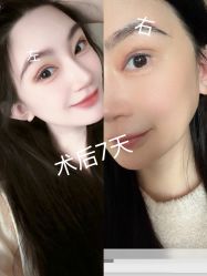 -天津伊美尔医疗整形美容专科医院