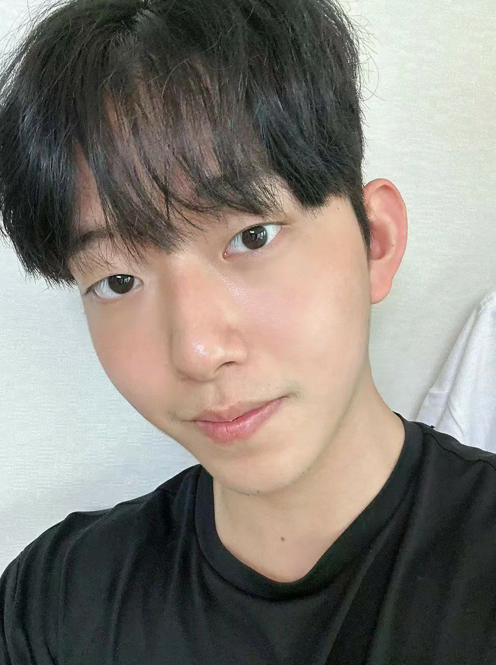 00后清纯男大做黄金微针