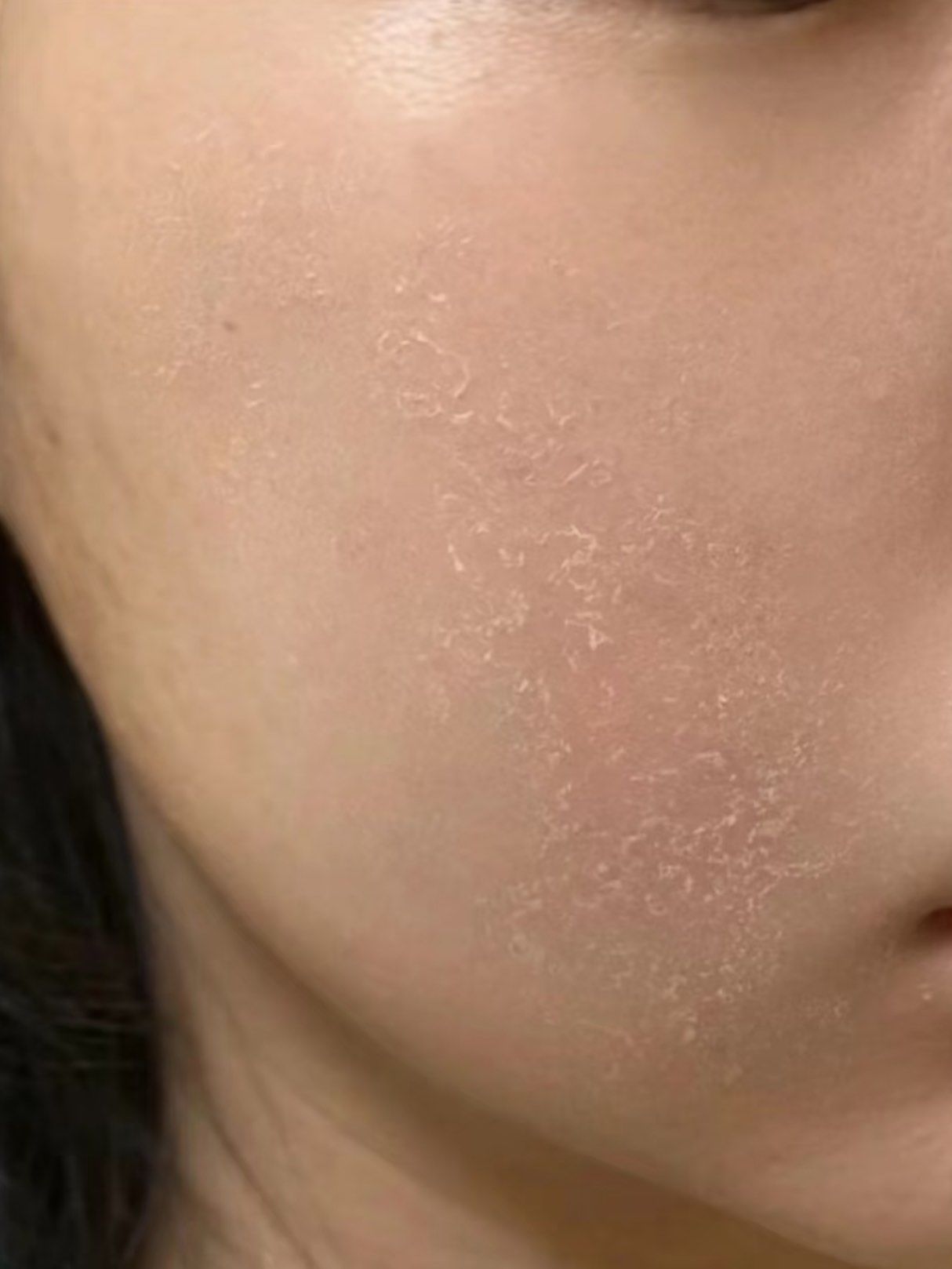 干到起皮怎么办