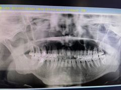 -优诺口腔·VIP尊享中心(爱建机构)