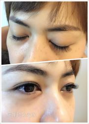 睫毛嫁接-光SPA科技美肤