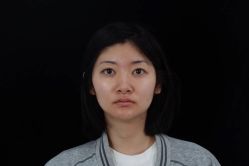 体验前-丰联丽格医疗美容·联合丽格眼整形中心