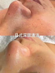-SKIN79皮肤管理中心