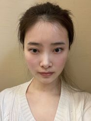 体验后-上海玫瑰医疗美容医院