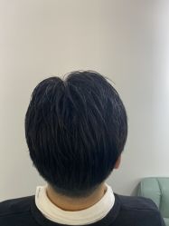 -发饰美男士增发补发假发定制店