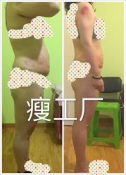 -摩瘦纤体订制减肥