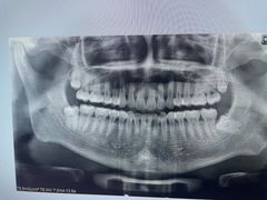 -诺贝尔一诺口腔医院(雁塔院区)